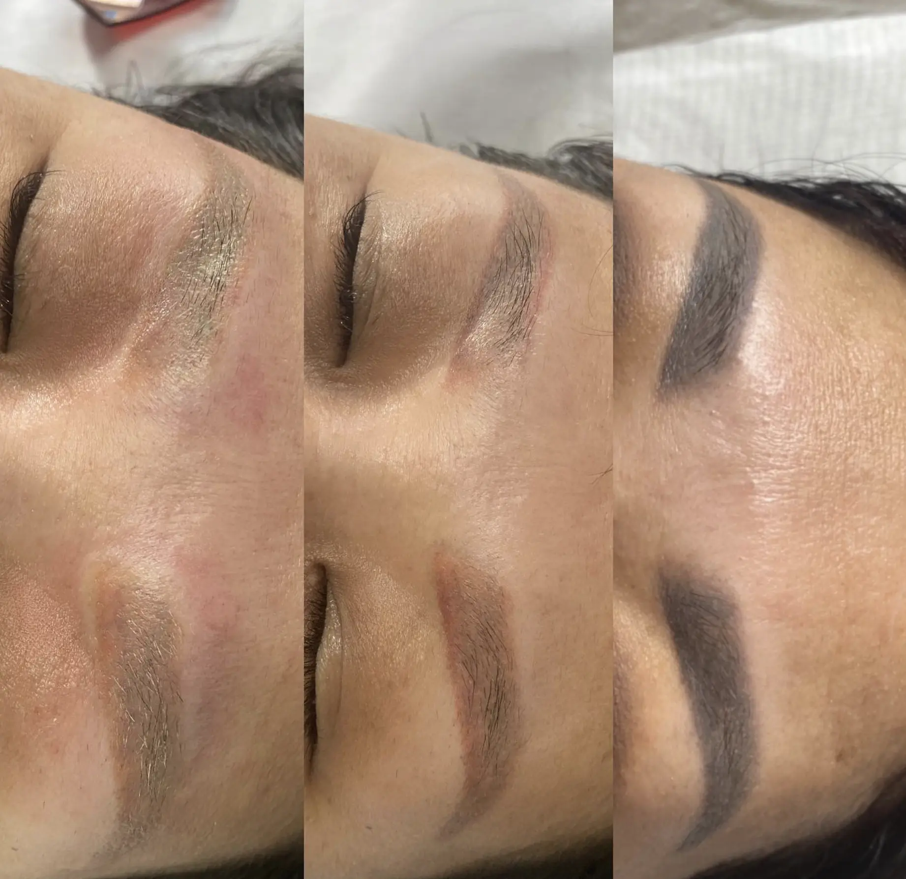 remove eyebrow tattoo